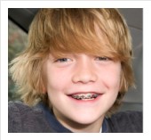 kids braces in San Jose