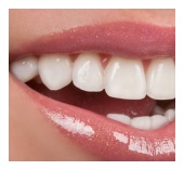 dental crown San Jose