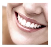 veneers, cosmetic dentist in San Jose